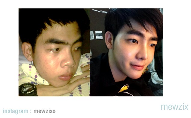 ศัลยกรรม